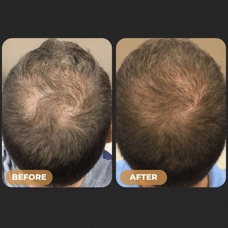 SPARTAN™ - Root Activator Spray