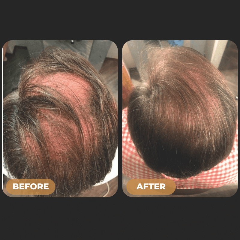 SPARTAN™ - Root Activator Conditioner