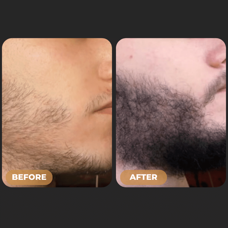 SPARTAN™ - Beard Growth Oil
